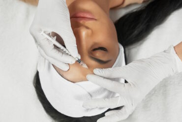 Čo je botox a ako to funguje?