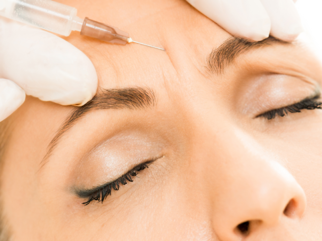 botox vrásky estetická klinika